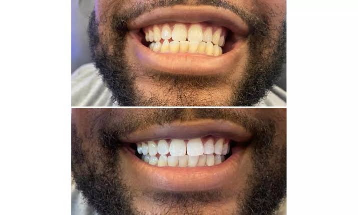 17682258781109202617129359353893